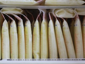 Idap Sindrom Langka, Wanita Ini Bisa Produksi 5 Liter ASI per Hari