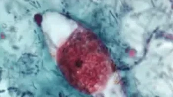 Cystoispora Belli (Isospora Belli) adalah parasit usus yang dapat menyebabkan penyakit pada manusia yang disebut cystoisosporiasis. Foto: U.S. Centers for Disease Control and Prevention (CDC)