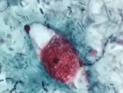 Cantik Tapi Berbahaya, Potret Virus di Bawah Lensa Mikroskop