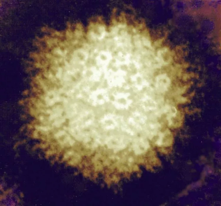 Foto virus Virus