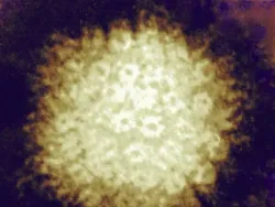 Cantik Tapi Berbahaya, Potret Virus di Bawah Lensa Mikroskop