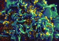 Virus