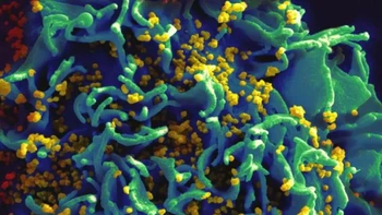 Pembesaran sel CD4 yang terinfeksi HIV. Foto: National Institute of Allergies and Infectious Diseases (NIAID)