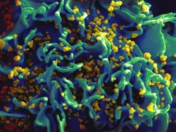 Cantik Tapi Berbahaya, Potret Virus di Bawah Lensa Mikroskop