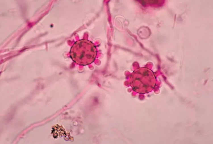 H. capsulatum merupakan salah satu jamur yang dapat menyebabkan penyakit pada manusia yang disebut dengan histoplasmosis. H. capsulatum. Ini adalah endemik di sebagian A.S., serta sebagian Afrika, Asia Tenggara, Eropa Selatan, serta Amerika Tengah dan Selatan.