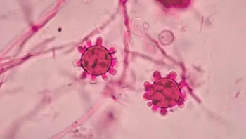 H. capsulatum merupakan salah satu jamur yang dapat menyebabkan penyakit pada manusia yang disebut dengan histoplasmosis. H. capsulatum. Ini adalah endemik di sebagian A.S., serta sebagian Afrika, Asia Tenggara, Eropa Selatan, serta Amerika Tengah dan Selatan. Foto: CDC/Dr. Libero Ajello