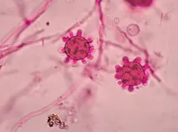 Cantik Tapi Berbahaya, Potret Virus di Bawah Lensa Mikroskop