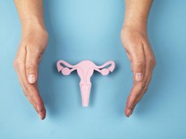 Ada 36 Ribu Wanita RI Kena Kanker Serviks, Banyak yang Ketahuan di Stadium Akhir