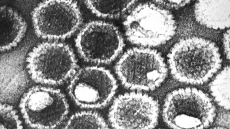 virus herpes Tampilan dari virus herpes.