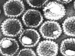 Cantik Tapi Berbahaya, Potret Virus di Bawah Lensa Mikroskop