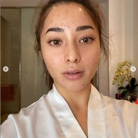 Bukannya membaik, jerawatnya malah tambah parah. Ia pun pergi ke klinik kecantikan dan berkonsultasi dengan dokter. Foto: Instagram/nikitawillyofficial94