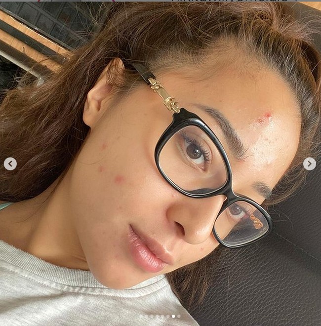 Selama tiga bulan, bintang sinetron Ganteng-ganteng Serigala ini rajin infus diamond di klinik dua minggu sekali. Foto: Instagram/nikitawillyofficial94