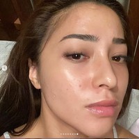 Awal 2021 jadi momen berat bagi Nikita Willy. Sepulangnya dari Raja Ampat, wajahnya ditumbuhi jerawat. Foto: Instagram/nikitawillyofficial94