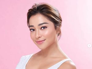 8 Foto Artis Cantik Indonesia saat Pamer Jerawat, Tetap Memukau!
