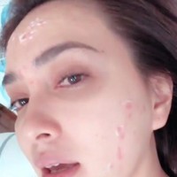 Kerap kali terlihat tampil dengan kulit mulus, ternyata Shandy Aulia juga pernah mengalami masalah jerawat pada kulit wajahnya. Walaupun demikian, Shandy dengan percaya diri mengunggah dan membagikan foto wajah berjerawatnya. Tetap cantik bukan? Foto: Instagram/@shandyaulia
