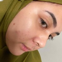 Walaupun mengaku sempat dibully karena wajahnya berjerawat namun Kesha Ratuliu dengan percaya diri memperlihatkan foto wajahnya ketika berjerawat. Padahal jerawat adalah hal yang wajar loh dan bisa disembuhkan. Foto: Instagram/@kesharatuliu05