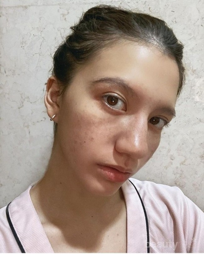 Cassandra Lee sempat terlihat mengunggah foto wajahnya tanpa pulasan makeup dan saat sedang berjerawat. Foto tersebut justru membuatnya tetap terlihat cantik natural. Bagaimana menurutmu? Foto: Instagram/@cassandraslee