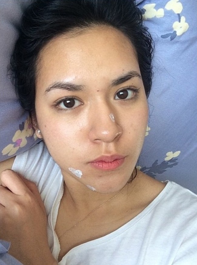 Salah satu penyanyi cantik Indonesia, Raisa, juga pernah membagikan foto ketika wajahnya sedang berjerawat. Dalam foto yang dibagikannya itu Raisa tampak tengah mengenakan obat totol jerawat. Walaupun sedang berjerawat namun Raisa tetap terlihat cantik ya.. Foto: Instagram/@raisa6690