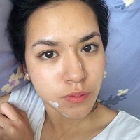 Salah satu penyanyi cantik Indonesia, Raisa, juga pernah membagikan foto ketika wajahnya sedang berjerawat. Dalam foto yang dibagikannya itu Raisa tampak tengah mengenakan obat totol jerawat. Walaupun sedang berjerawat namun Raisa tetap terlihat cantik ya.. Foto: Instagram/@raisa6690