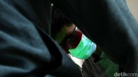 Butuh ketelitian dalam melakukan proses penghapusan tato agar hasilnya maksimal.