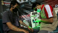 Relawan melakukan sejumlah tahapan dalam menghapus tato di tangan warga.