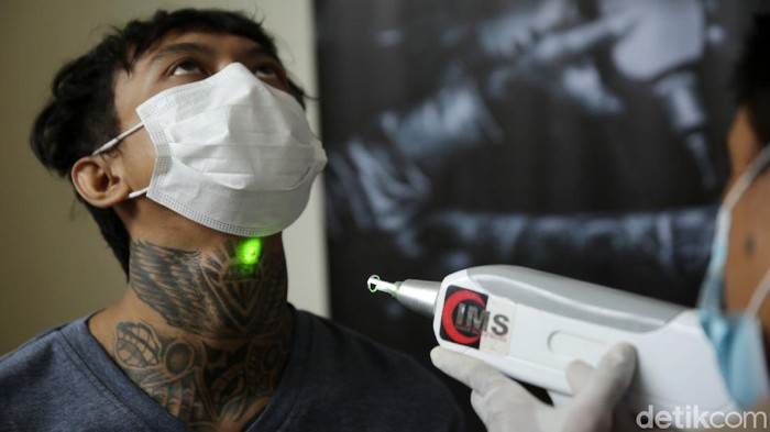 Begini Proses Menghapus Tato pada Tubuh Warga menjalani hapus tato di Masjid Baitul Muhyi di Kompleks Kantor Wali Kota Jakarta Timur, Jumat (30/4/2021). Islamic Medical Service (IMS) dan Baznas DKI Jakarta menggelar program Hapus Tato Keliling Jakarta selama bulan Ramadhan dan menargetkan 550 peserta. Selama dua hari di masjid tersebut, 137 peserta menjalani hapus tato.