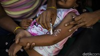 Seorang anak nampak tengah diberikan obat.