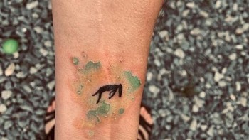 Memodifikasi bekas luka. Akhirnya menjadi karya seni. Foto: Brightside