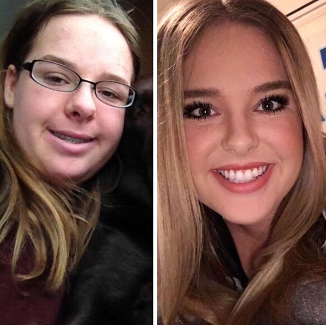 Usia 16 vs 20 tahun. Wanita ini berubah drastis hingga nyaris tak dikenali. Foto: Instagram, Reddit