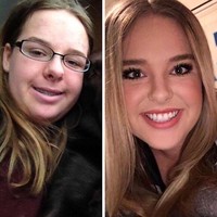 Usia 16 vs 20 tahun. Wanita ini berubah drastis hingga nyaris tak dikenali. Foto: Instagram, Reddit