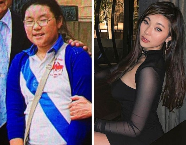 Akun Reddit @minjewe sering dipanggil jelek saat kecil dan remaja. Lihat penampilannya yang sekarang di usia 20 tahun. Foto: Instagram, Reddit