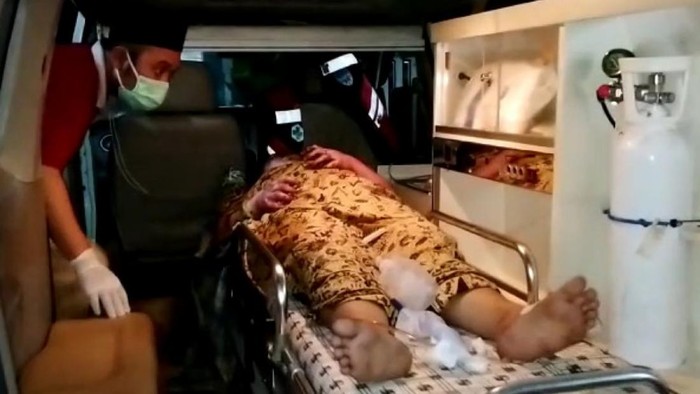 Wanita di Cianjur dibakar kekasih sendiri diduga sering cekcok