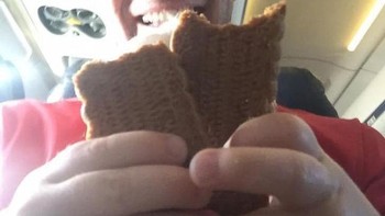 Pria bertangan bayi. Foto: dok Reddit via Brightside