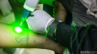 Meski rasanya lebih sakit menghapus tato dari pada membuat tato namun tidak ada kata terlambat untuk kembali ke jalan yang benar.