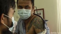 Nantinya setelah selesai di laser, bekas luka tato harus diberi salep luka bakar guna mengurangi rasa perih, luka bekas tato itu tidak boleh terkena air sampai pulih. Diketahui hari ini dan besok hapus tato gratis tengah ada di wilayah administrasi Jakarta Barat.