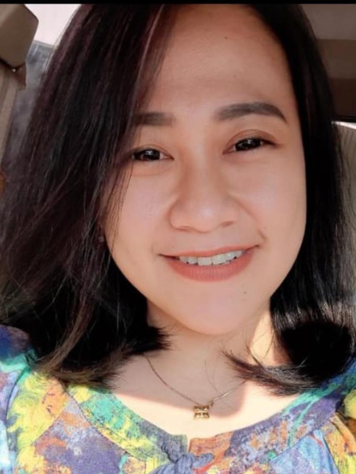 perawat cantik dibakar
