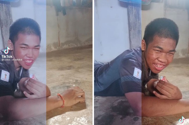 Permasalahan kulit seperti jerawat dapat dibasmi dengan filter viral satu ini. Seperti pria asal Thailand yang auto glowing, dan lebih mancung dengan kecanggihan filter. Foto: dok TikTok cekoi_chiwitdidi