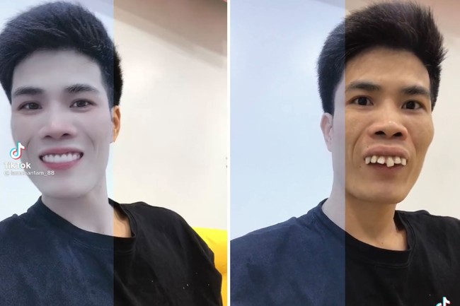 Half Filter yang digandrungi warga TikTok membuat penampilan seorang pria asal Vietnam manglingi. Bak sulap, giginya rapi tanpa harus memakai kawat gigi. Foto: dok TikTok lamchantan_88
