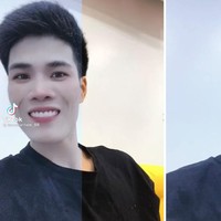 Half Filter yang digandrungi warga TikTok membuat penampilan seorang pria asal Vietnam manglingi. Bak sulap, giginya rapi tanpa harus memakai kawat gigi. Foto: dok TikTok lamchantan_88