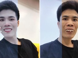 Foto: 8 Transformasi Kocak Pengguna Half Filter yang Viral di TikTok