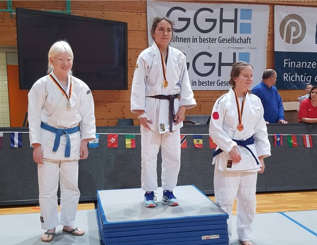 “Penyandang disabilitas atau perbedaan kini semakin banyak ditampilkan di media dan ini bagus, tapi seharusnya itu hal yang normal. Model albino sering mendapatkan stereotip dalam pemotretan untuk menggambarkan malaikat atau hantu dan itu membuatku sedih, ungkap Xueli. Foto: dok. Instagram/@xueli_a