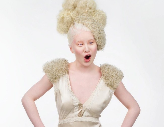 Model albino ini jadi sorotan, tak hanya karena spesial, namun juga punya kisah masa lalu yang kelam. Xueli Abbing dianggap sebagai anak kutukan oleh orangtuanya karena menderita albinisme. Foto: dok. Instagram/@xueli_a