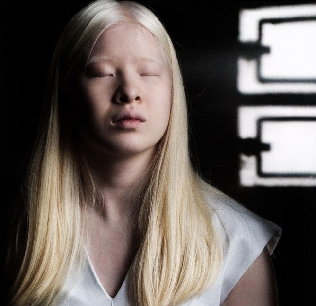 Xueli Abbing bahkan dibuang oleh orangtuanya dan ditinggalkan di pintu panti asuhan setelah di lahir. Di Tiongkok, anak albino kerap kali dianggap sebagai kutukan. Foto: dok. Instagram/@xueli_a