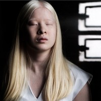 Xueli Abbing bahkan dibuang oleh orangtuanya dan ditinggalkan di pintu panti asuhan setelah di lahir. Di Tiongkok, anak albino kerap kali dianggap sebagai kutukan. Foto: dok. Instagram/@xueli_a