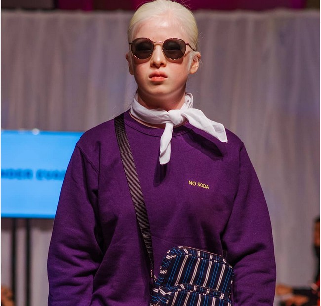 Inilah penampilan Xueli saat berjalan di catwalk. Kini Xueli pun menyuarakan dan memberikan motivasi bagi anak-anak penderita albino bahwa mereka bisa menjalani hidup dengan normal, dan bisa meraih kesuksesan. Foto: dok. Instagram/@xueli_a