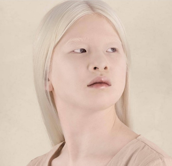 Kondisi disabilitasnya, dan masa lalu yang menyedihkan, tidak membuat Xueli jadi hancur. Dia justru kini menapaki kariernya sebagai model, dan sukses tampil di majalah Vogue Italia pada 2019. Foto: dok. Instagram/@xueli_a