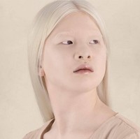 Kondisi disabilitasnya, dan masa lalu yang menyedihkan, tidak membuat Xueli jadi hancur. Dia justru kini menapaki kariernya sebagai model, dan sukses tampil di majalah Vogue Italia pada 2019. Foto: dok. Instagram/@xueli_a