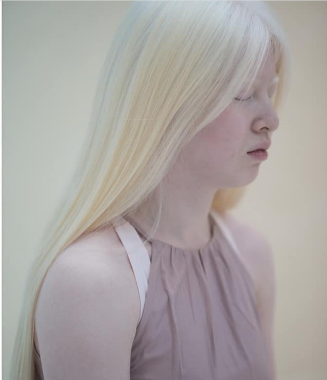 Beruntungnya, di usia tiga tahun Xueli diadopsi oleh keluarga Belanda. Ibu Xueli yang justru pada awalnya menawarinya sebagai model sampai ada agensi model yang merekrutnya. Foto: dok. Instagram/@xueli_a