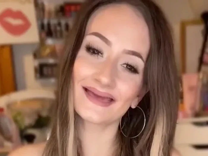 Bintang TikTok Tidak Punya Gigi Bintang TikTok Tidak Punya Gigi