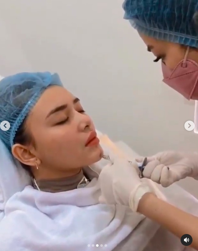 Menurut keterangan di video tersebut, Amanda Manopo sedang treatment punyuntikan vitamin E pada pipi dan dagu. Tujuannya agar bibir terlihat lebih tirus. (Foto: Instagram/@nurmala_suryani15)